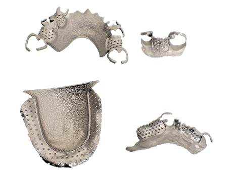 金属3Dプリンターで造形したチタン製 歯科補綴物・デンチャー